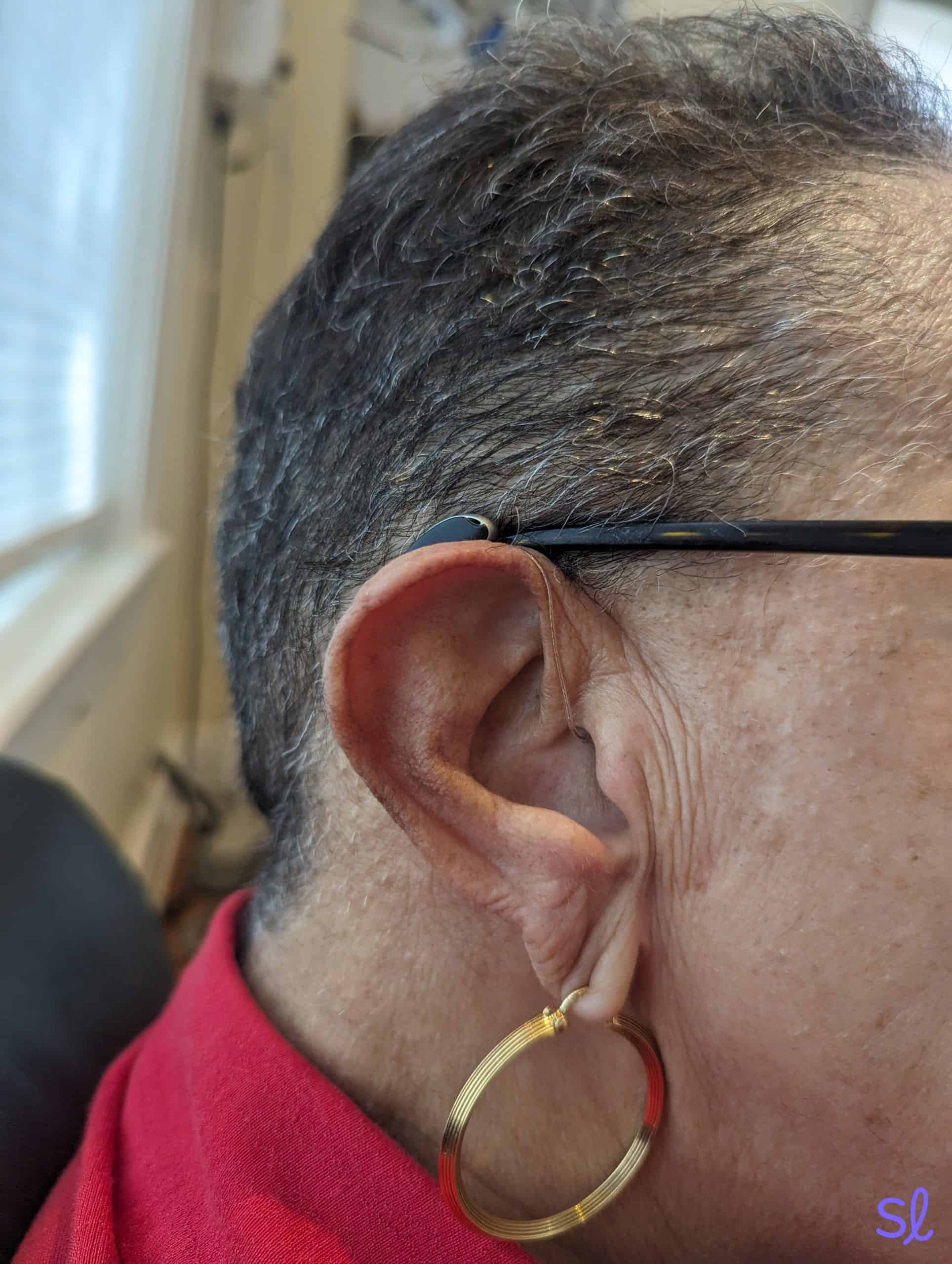 One of Dr. Reisman's patients wearing Signia Styletto hearing aids