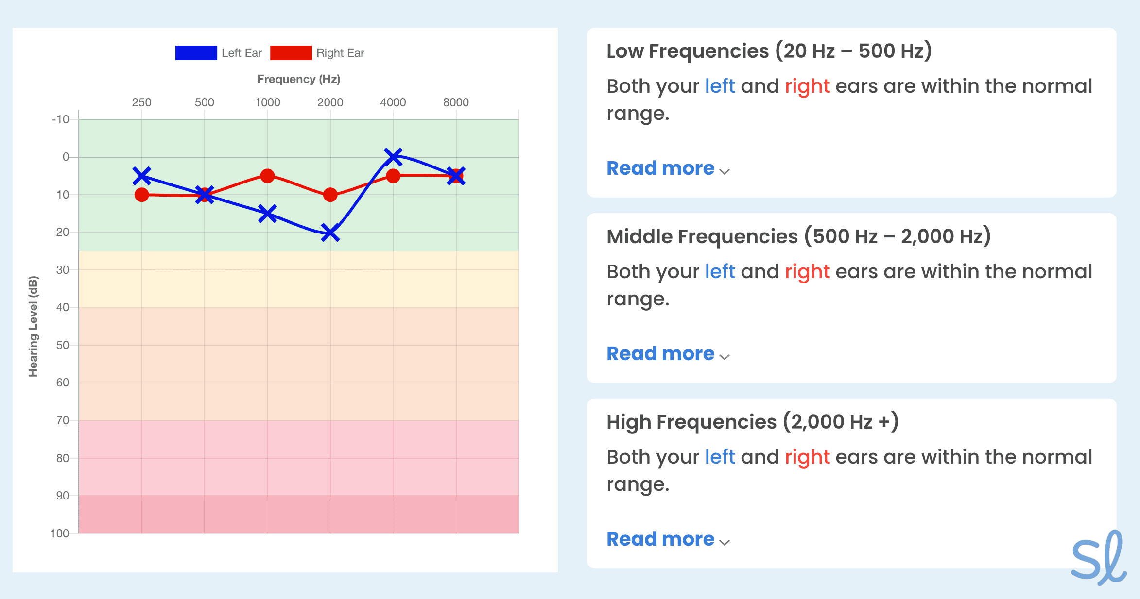 Viewing my hearing test audiogram